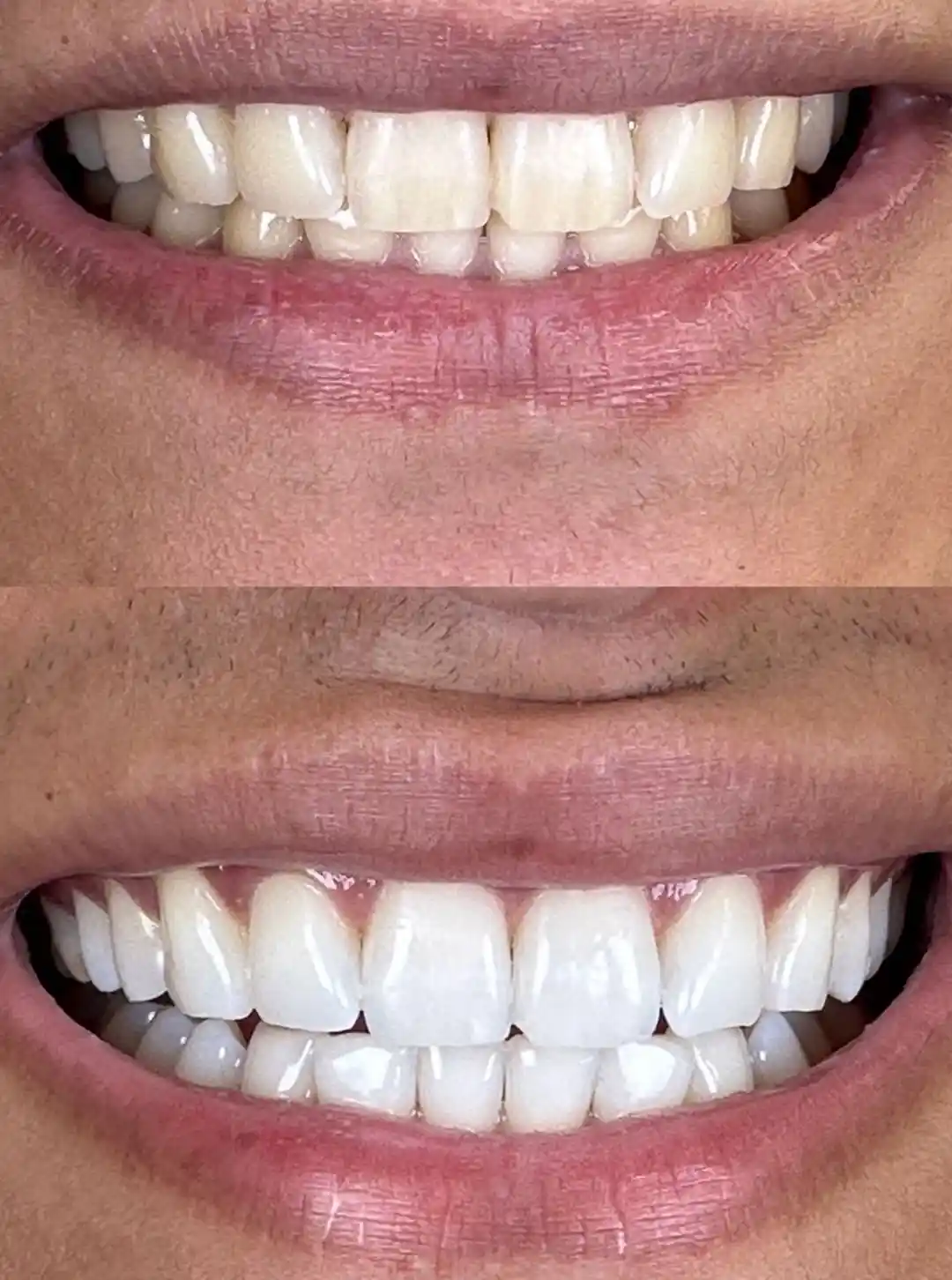 foto-carrossel-elaine-1