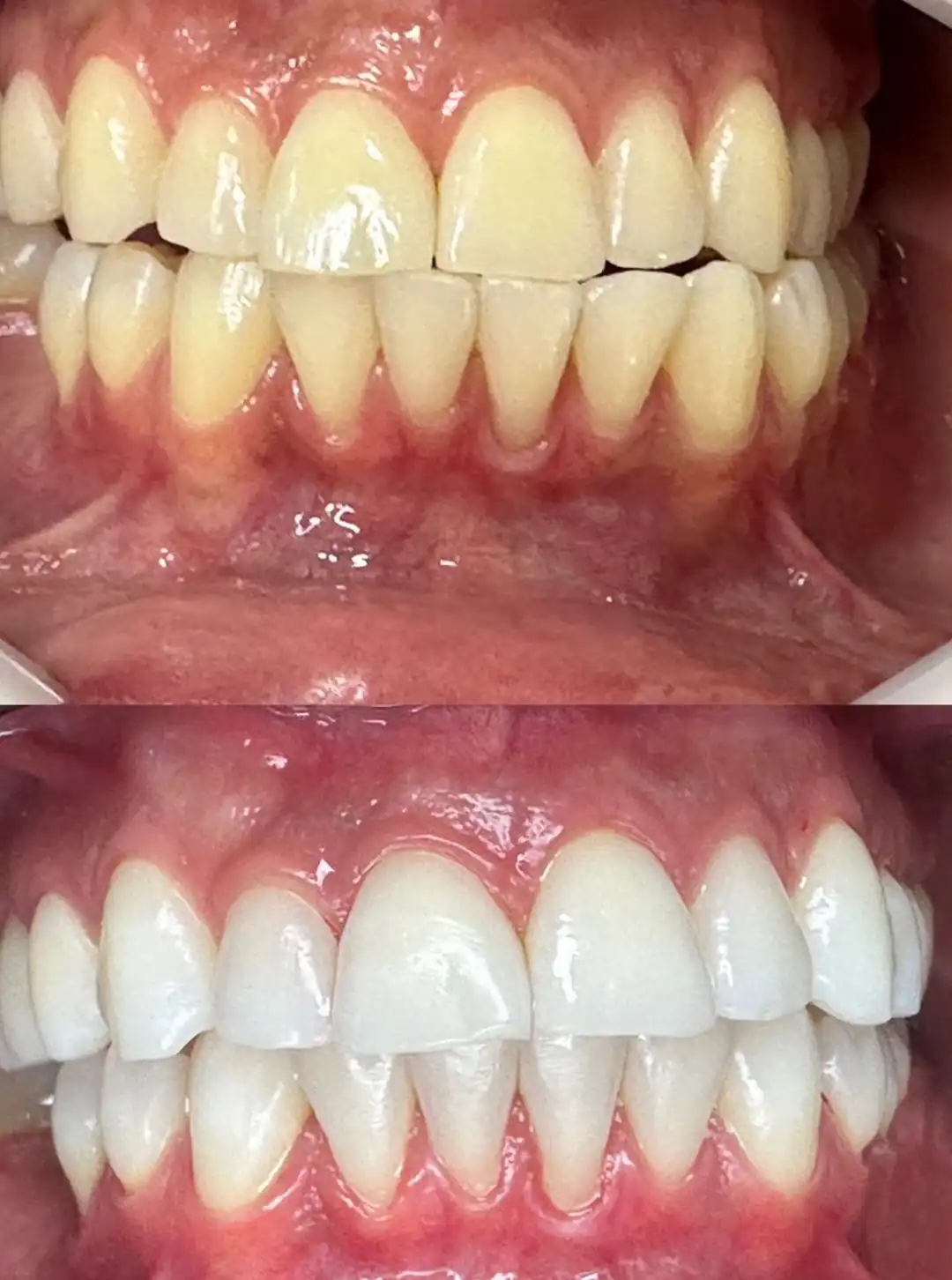 foto-carrossel-elaine-2