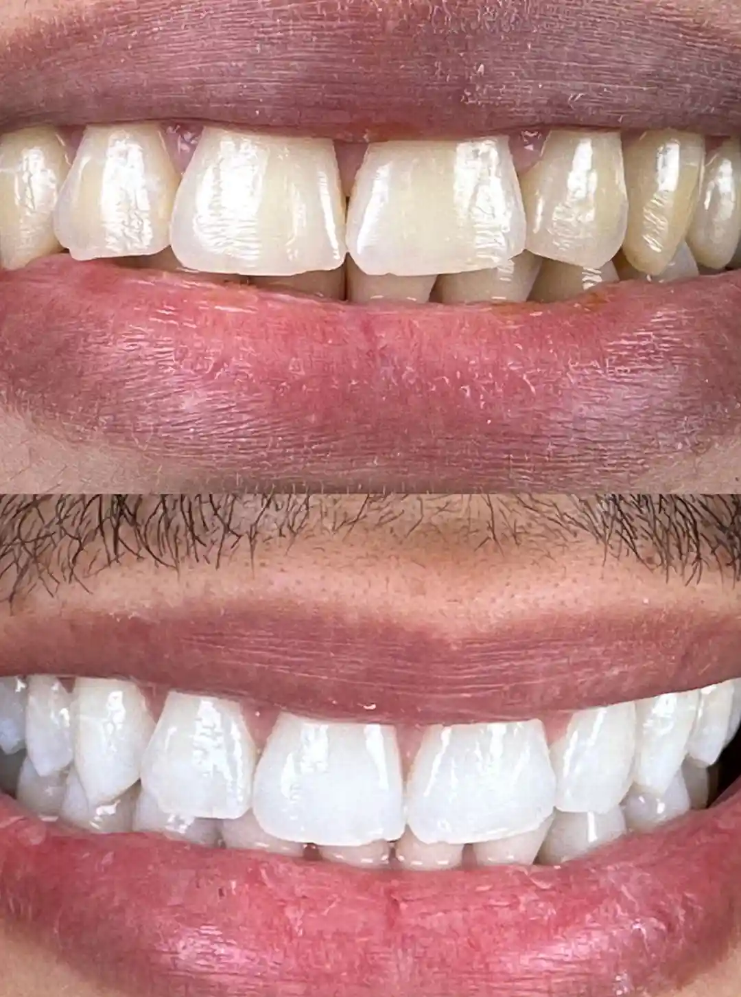 foto-carrossel-elaine-3