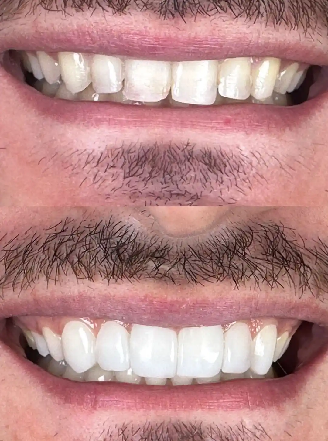 foto-carrossel-elaine-8