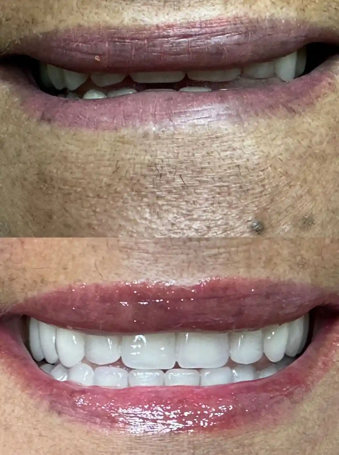 foto-carrossel-elaine-9